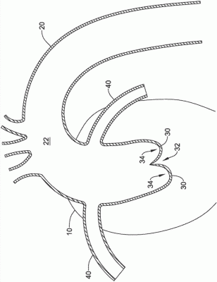 經導管主動脈瓣膜系統EVOLUTPRO-23-US