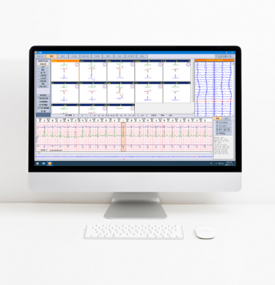 動(dòng)態(tài)心電圖分析系統jrt-y