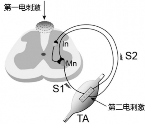 體外脊髓神經(jīng)刺激測試系統3599