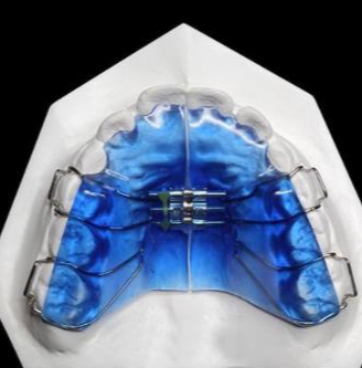 華偉定制式矯治器擴弓型、矯治保持型、牙膠片型